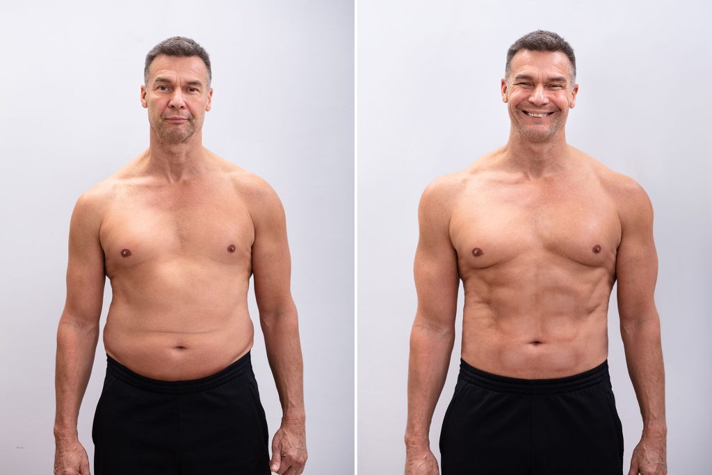 Before and after results showing fat reduction with body contouring.