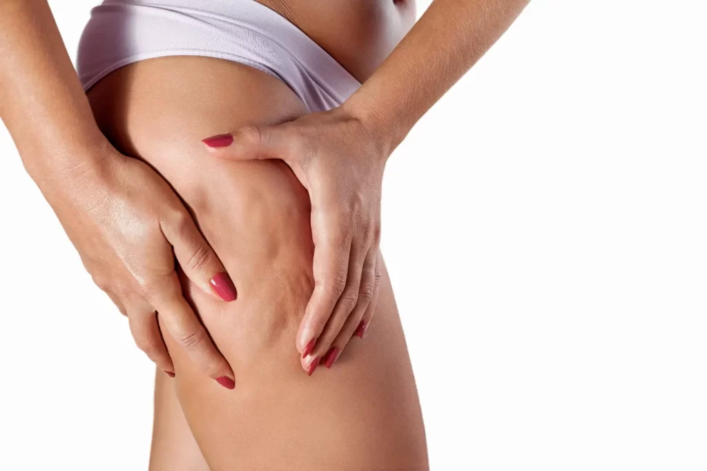 Close-up of hands pressing the skin on the upper thigh, highlighting the surface texture.